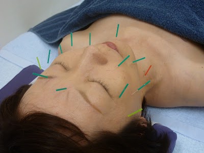 川井はり・きゅう接骨院