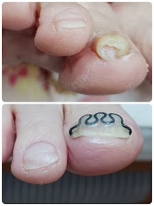 浜田巻き爪矯正センターSkip