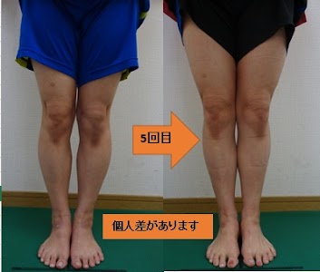 あおば鍼灸整骨院/むちうち腰痛