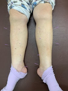 楽ナール鍼灸整骨院