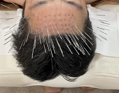 鍼灸サロン acus（アクス）