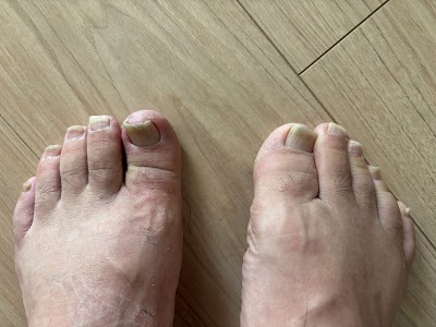 寒河江巻き爪フットケアセンター[巻き爪矯正・爪切り代行・変形爪ケア]