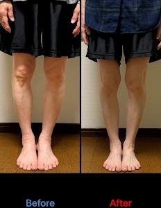 やました筋膜整体
