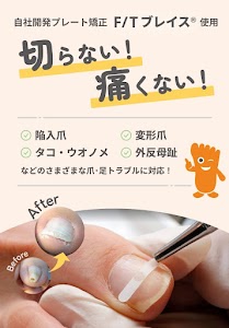 仙台巻き爪矯正院 【利府院】