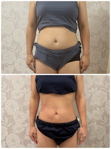 龍ケ崎の痩せたい人の為の美容整体&肌育専門 Body cure Grand